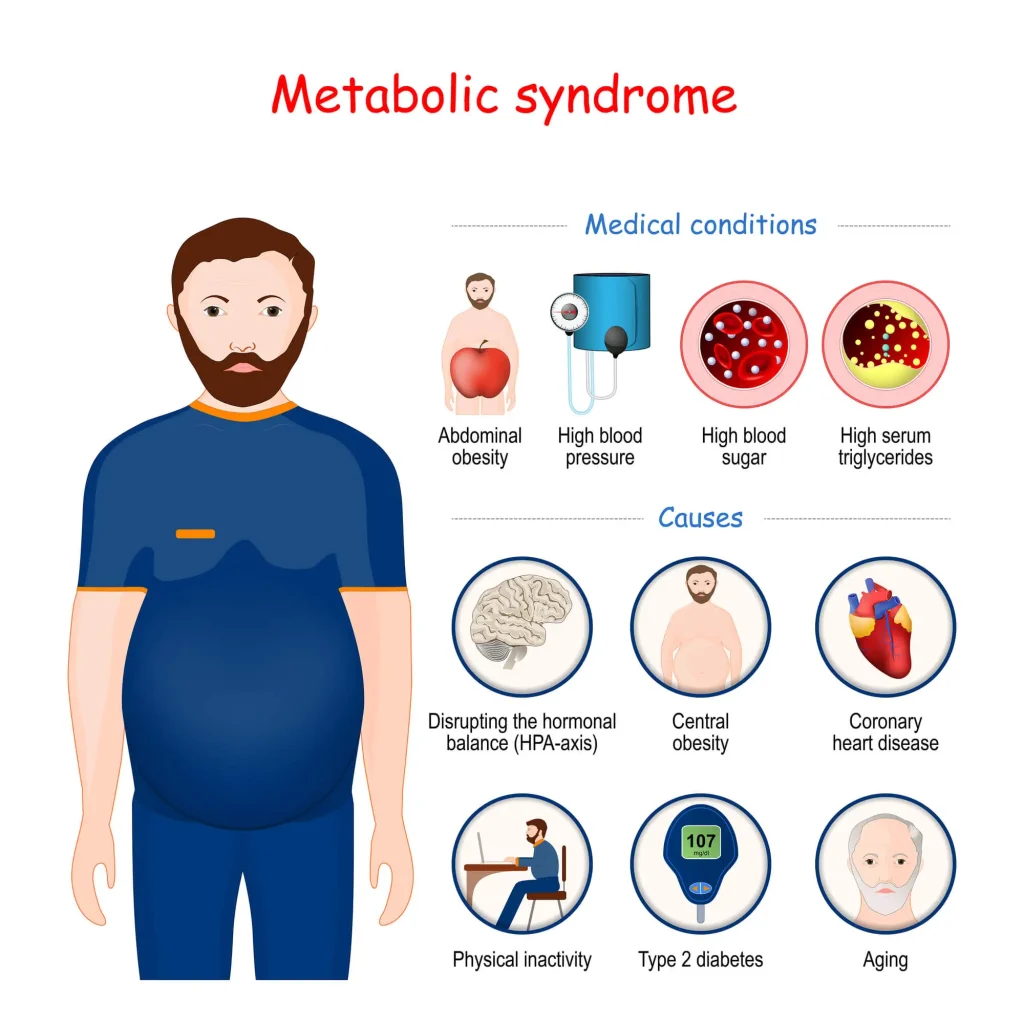 Metabolic syndrome treatment in Islamabad